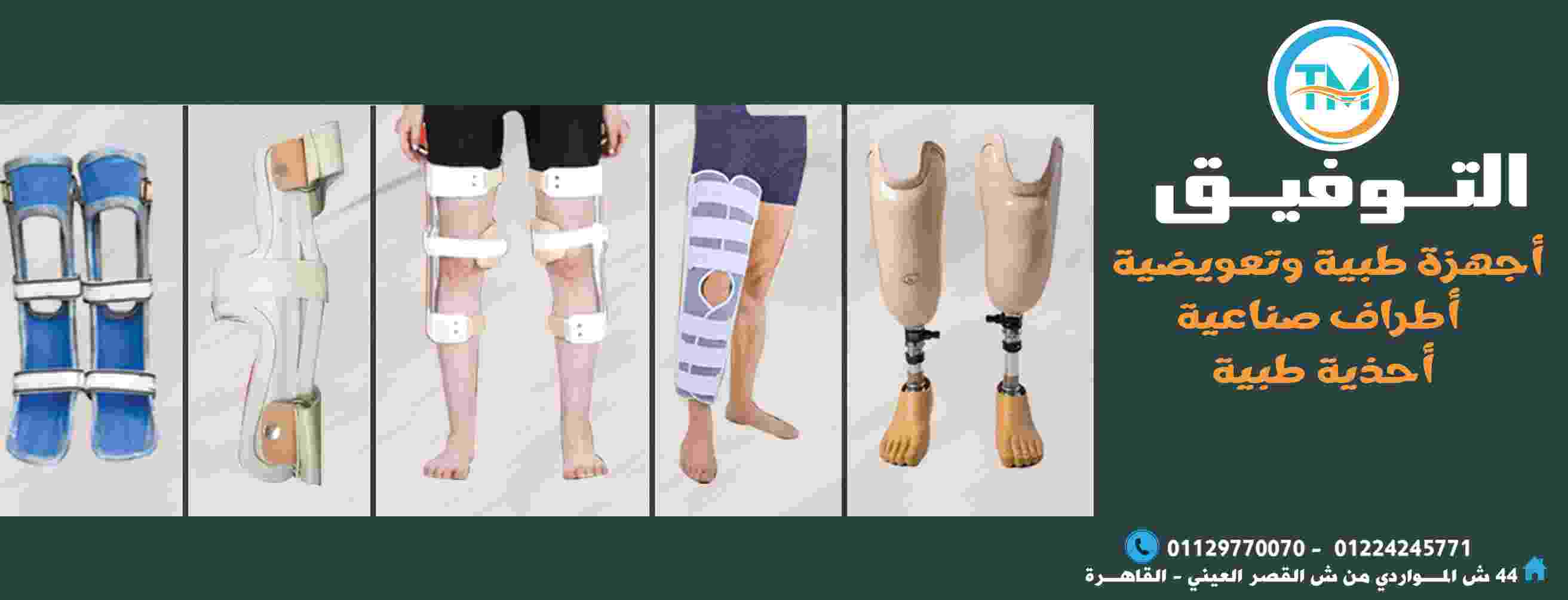 التوفيق للاطراف الصناعيه